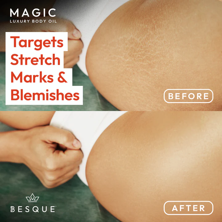 Besque Original Magic Body Oil - Hydrating Body Oils for Women - 3.4 FL OZ | Skin Care Body Oils for Women That Plump, Tighten & Firm Skin With Natural Ingredients, Made in UK